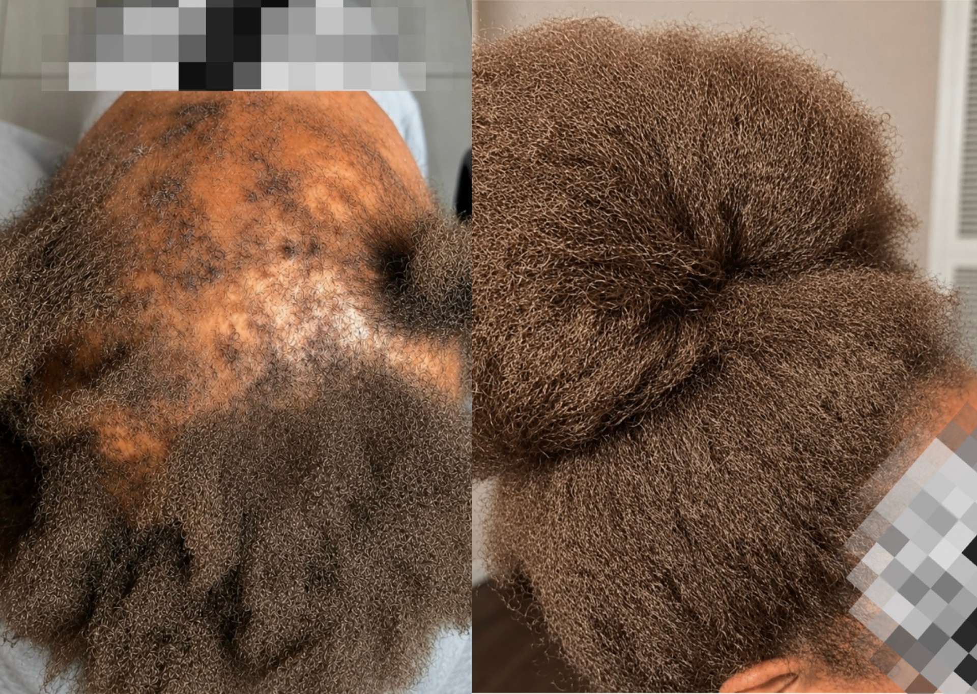 Before and after transformation 2