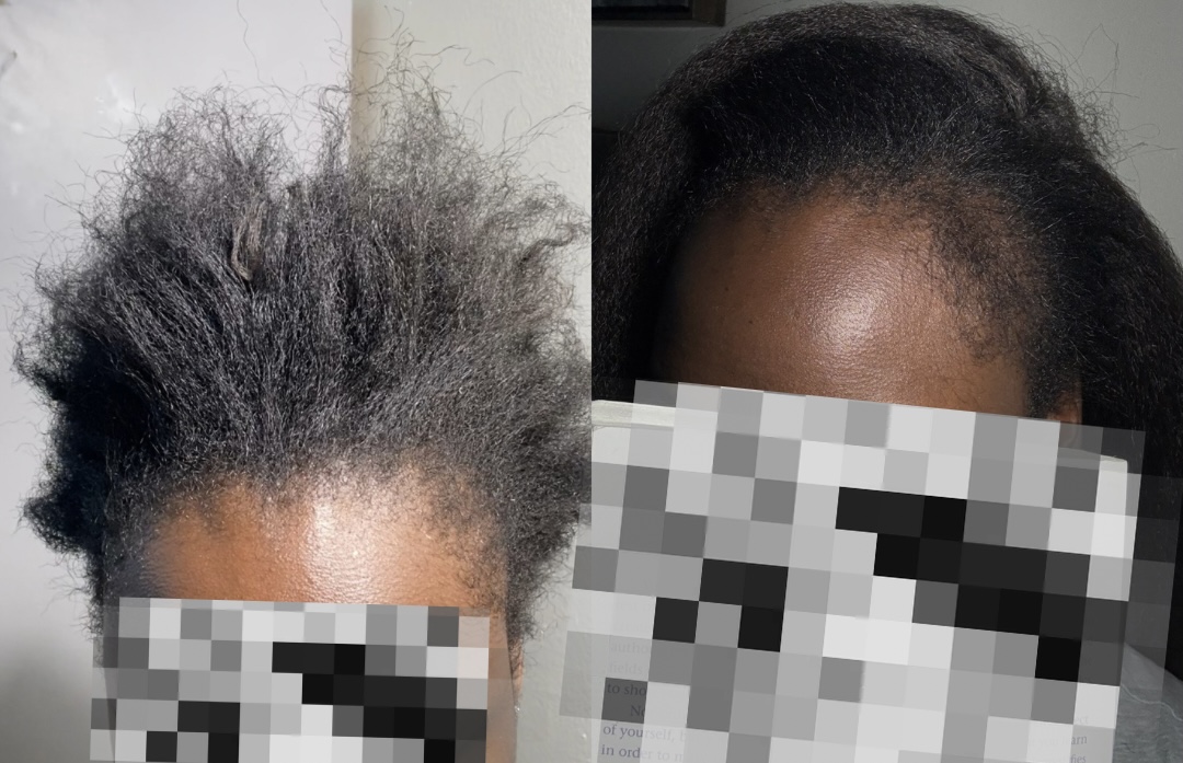 Before and after transformation 1