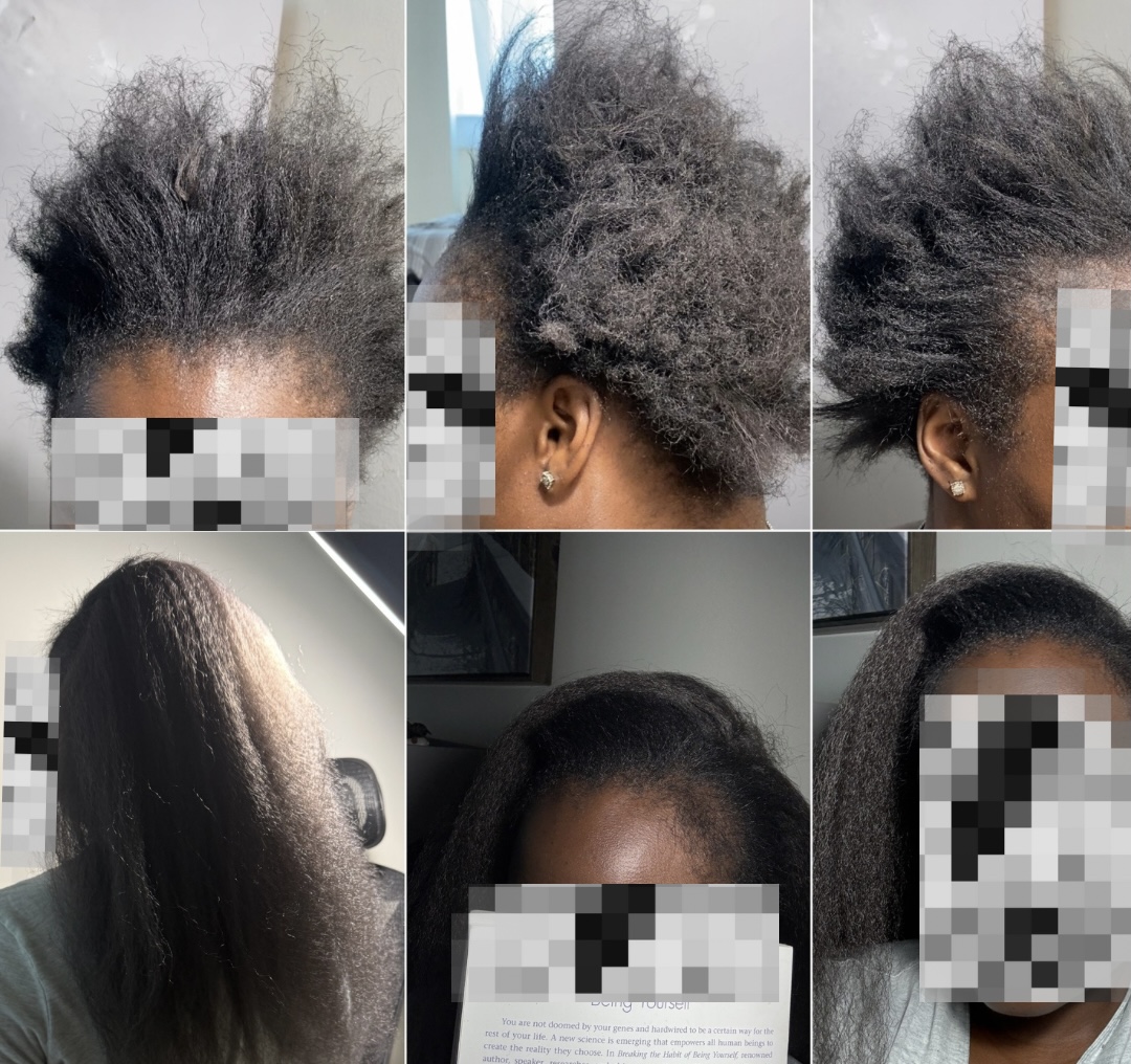 Before and after transformation 4