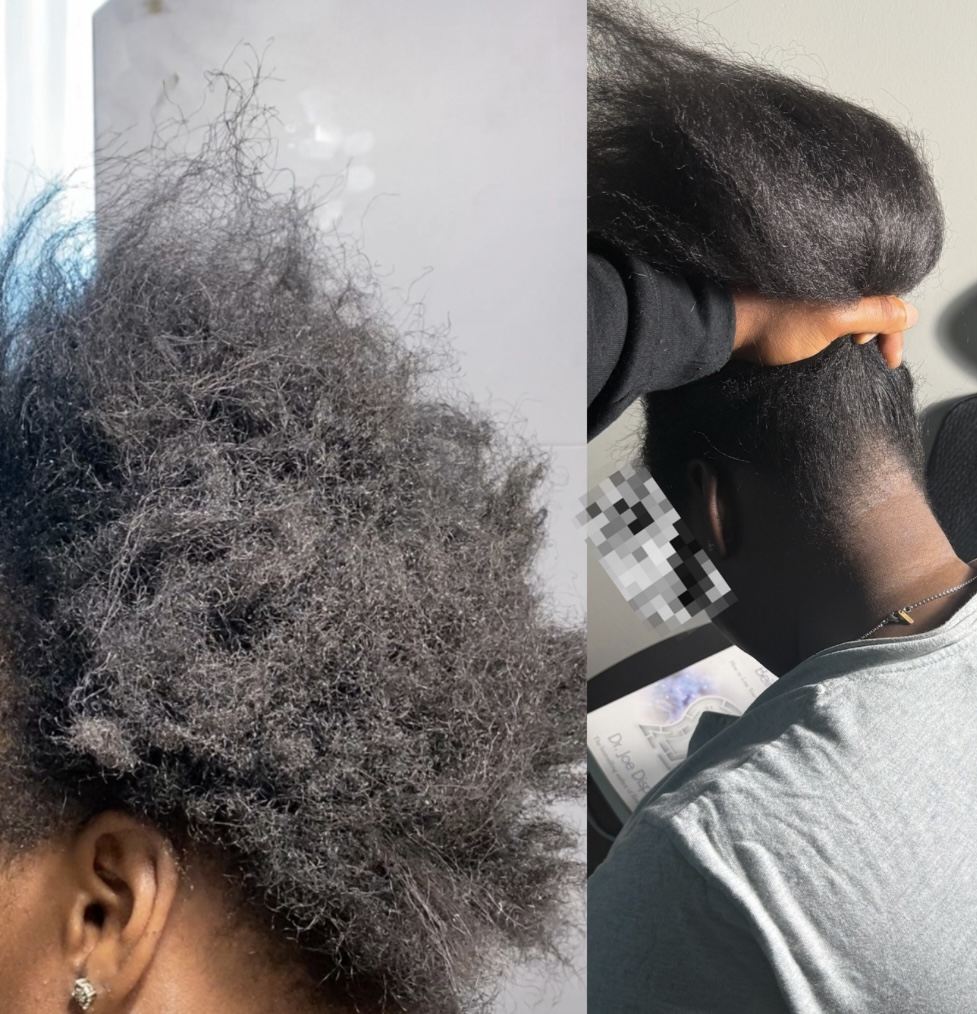 Before and after transformation 3